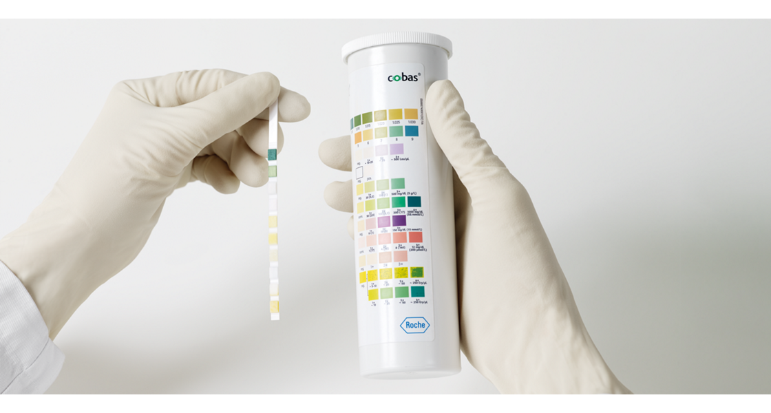 Urinalysis