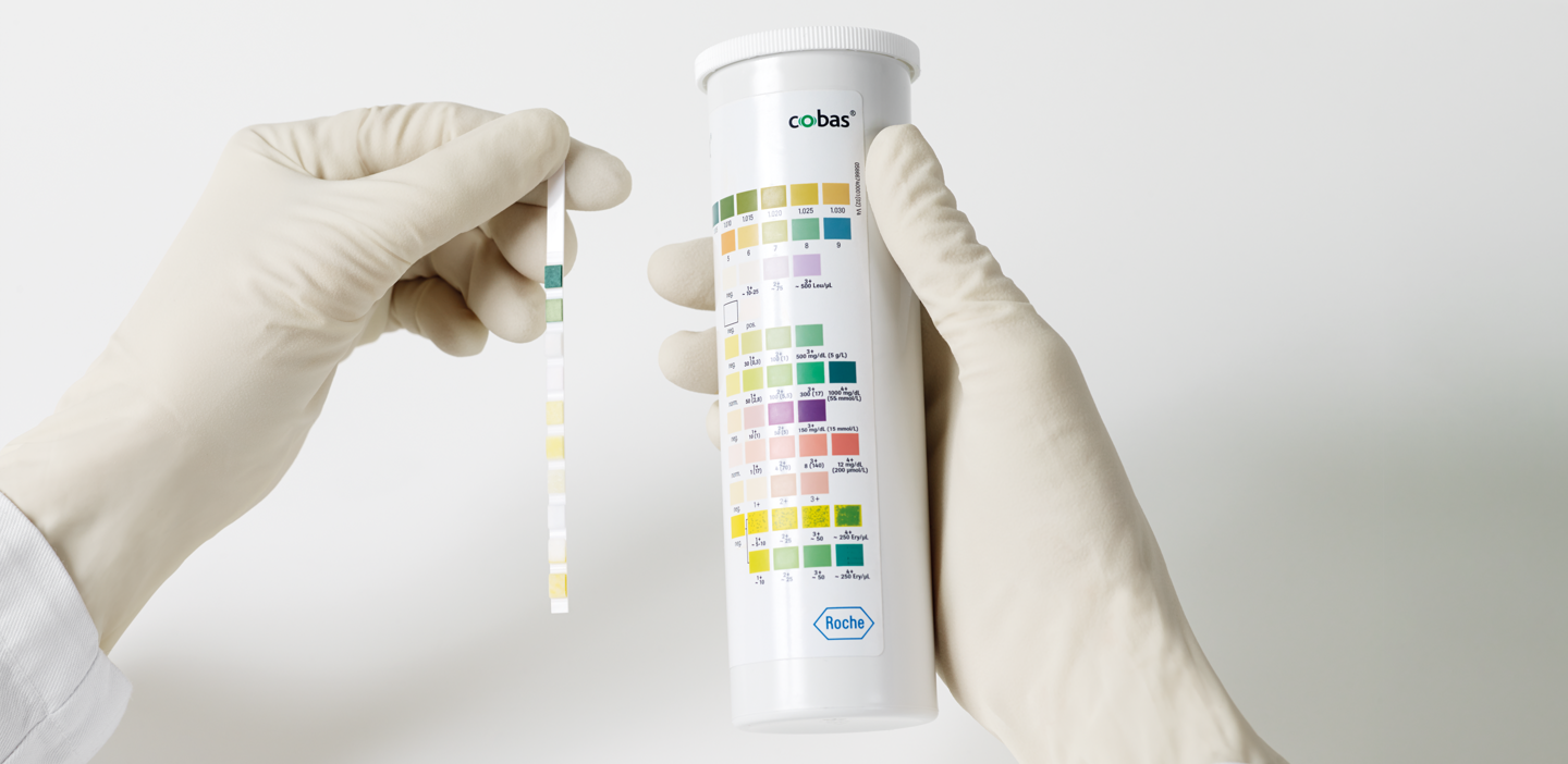 Les bandelettes de diagnostic urinaire Combur Test® Roche f&ecirc;tent leurs 50 ans