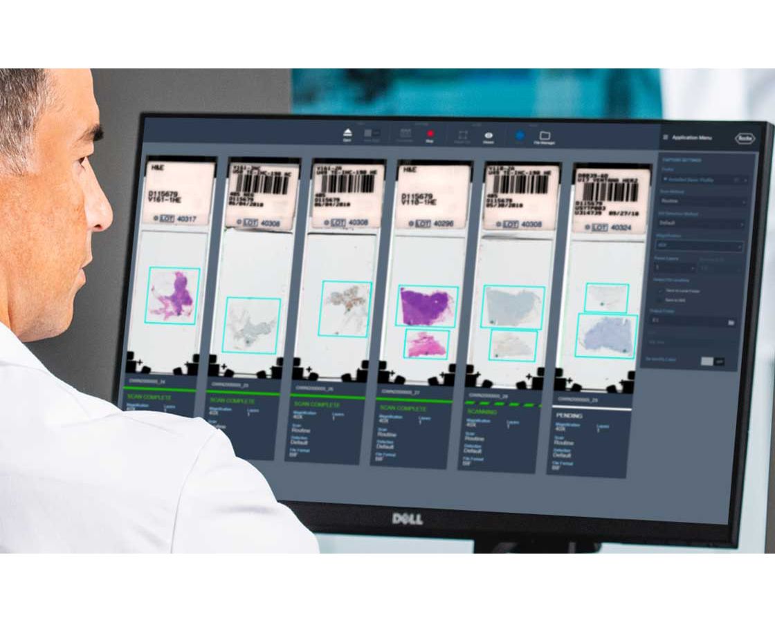Digital pathology image analysis algorithms