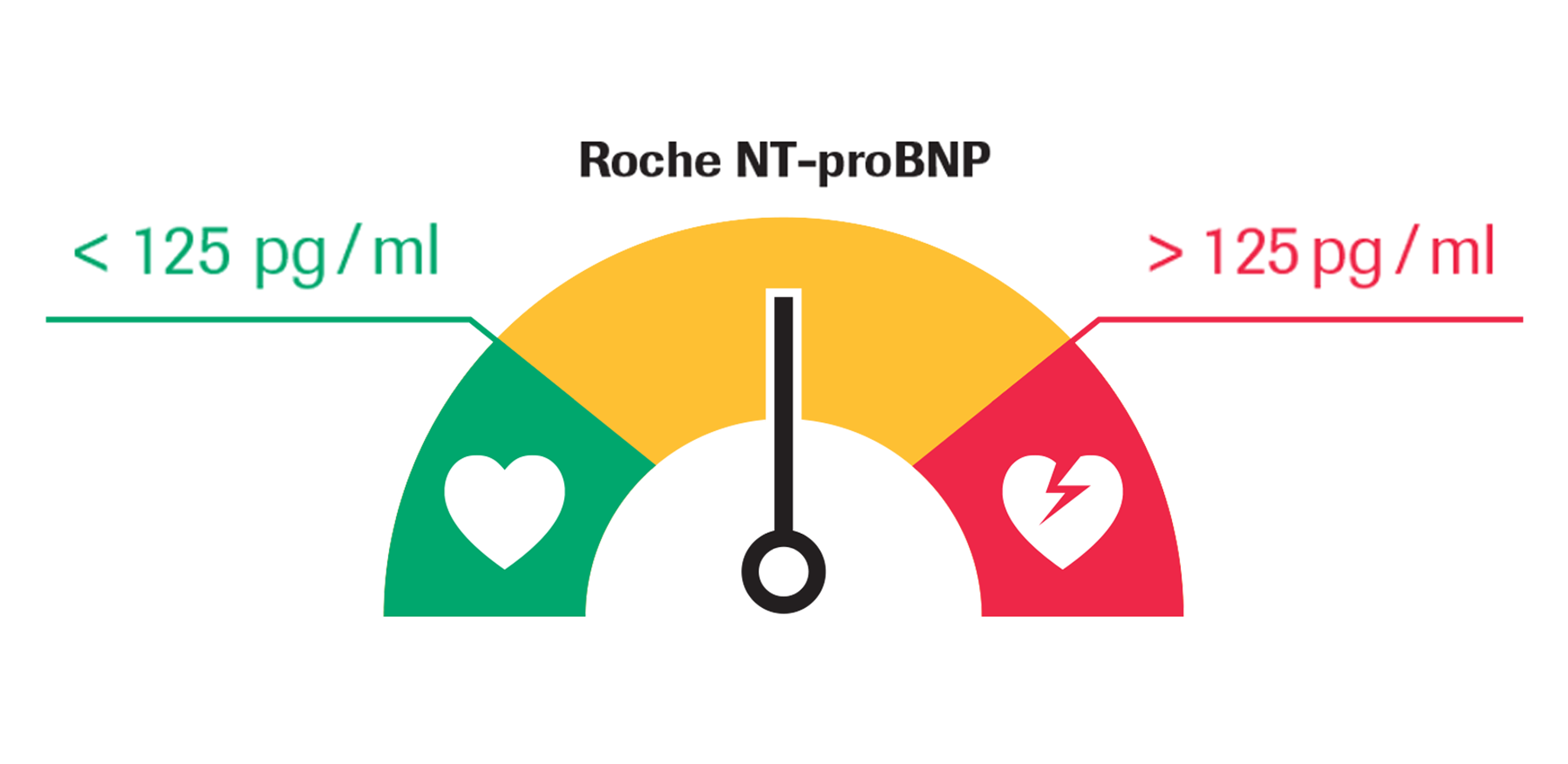 Major role of Roche NT-proBNP as the initial test for diagnosing heart ...