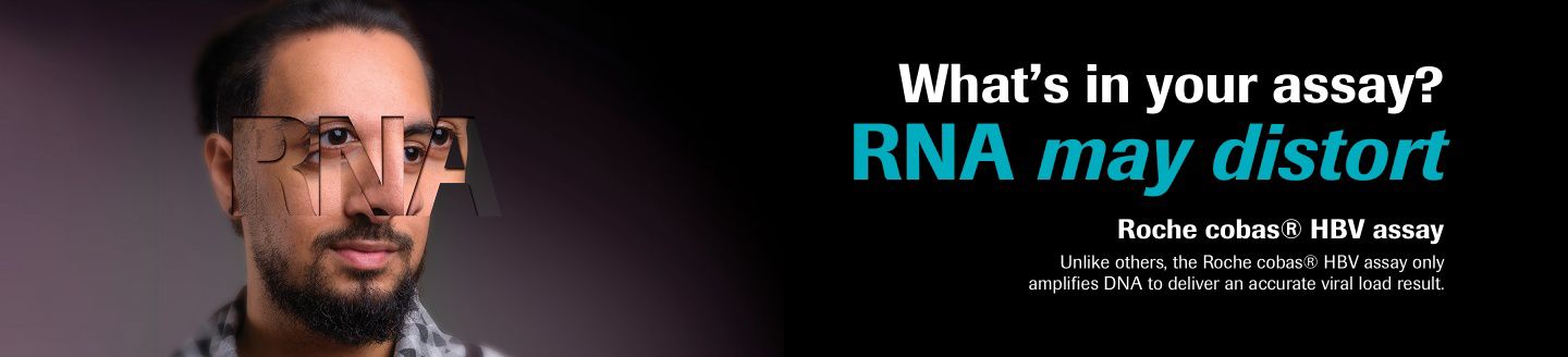 RNA distorts banner image