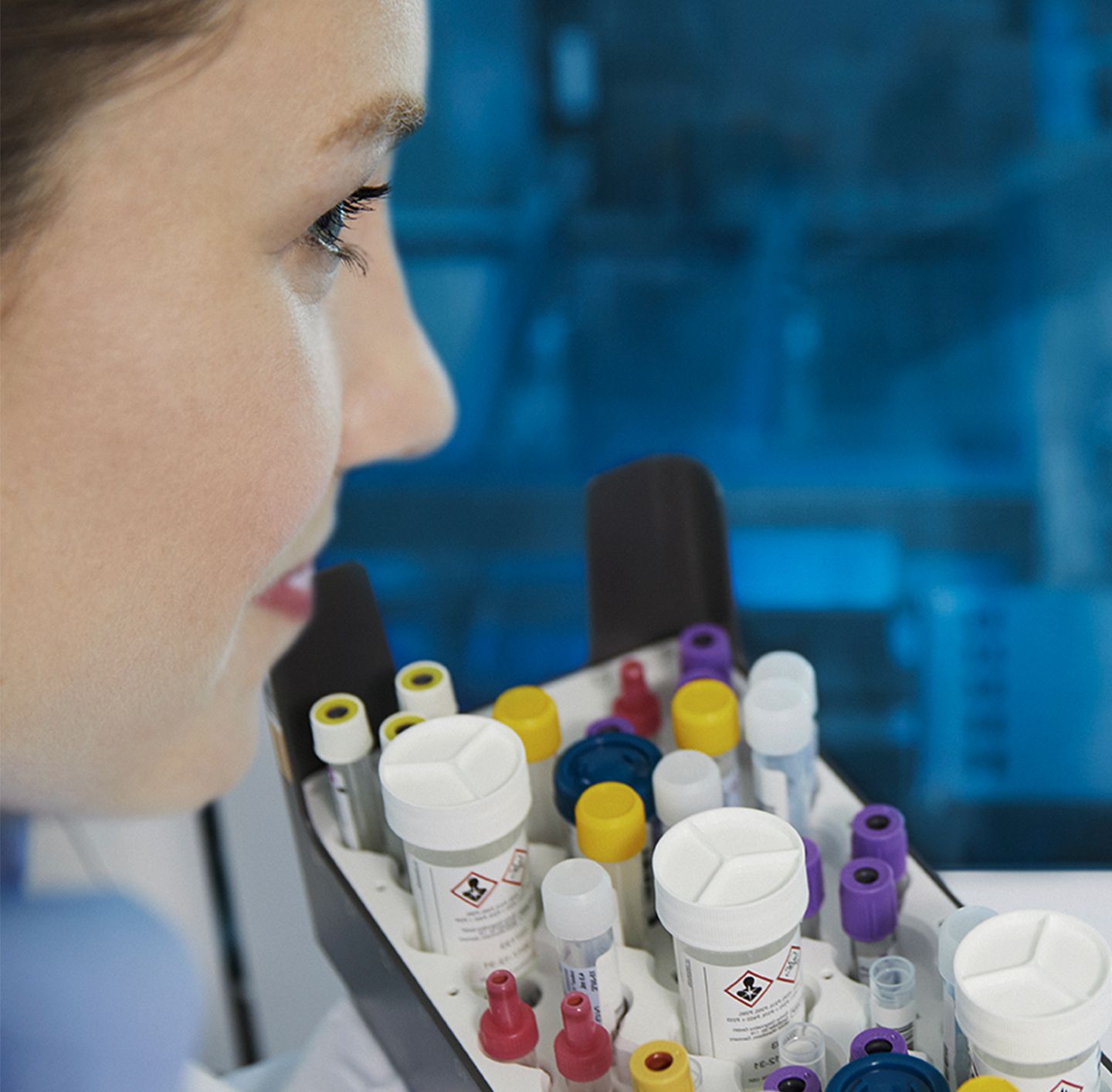 cobas® prime Preanalytical System