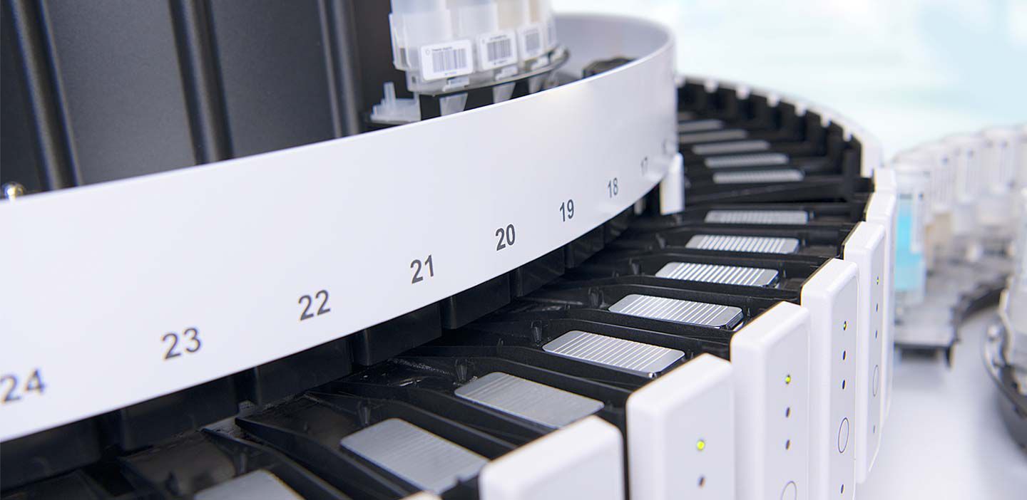 Benchmark Ultra Plus Procedure Chart.pdf Roche Diagnostics