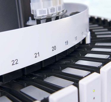 Benchmark Ultra Plus Procedure Chart.pdf Roche Diagnostics