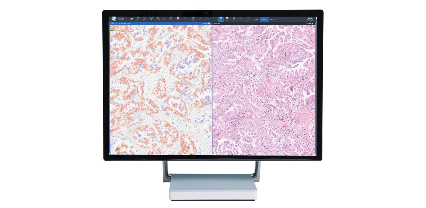 Image analysis for slide images stained with the VENTANA PD-L1 (SP263) Assay