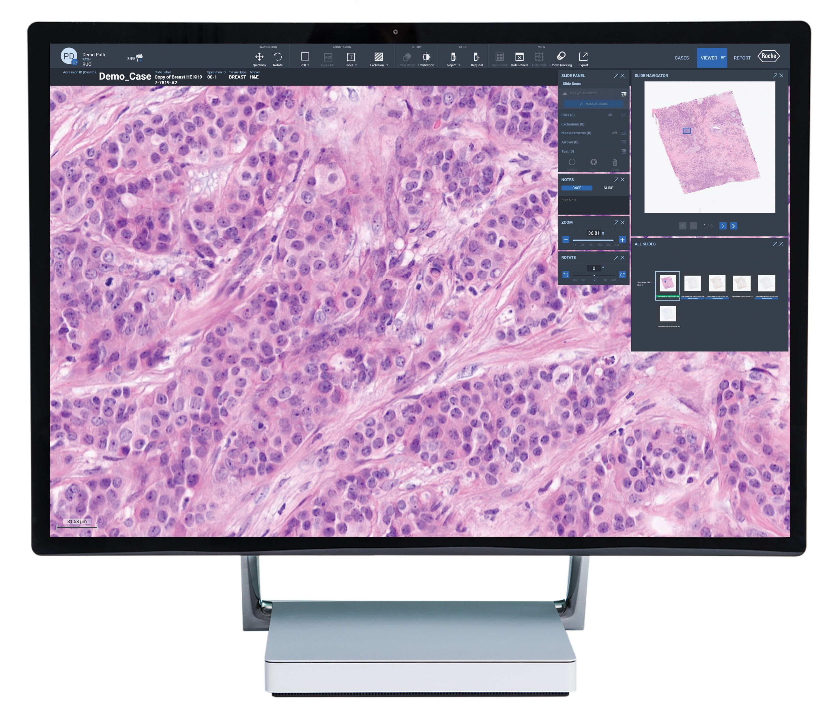 Roche uPath software seamlessly enables communication between pathologists and technicians