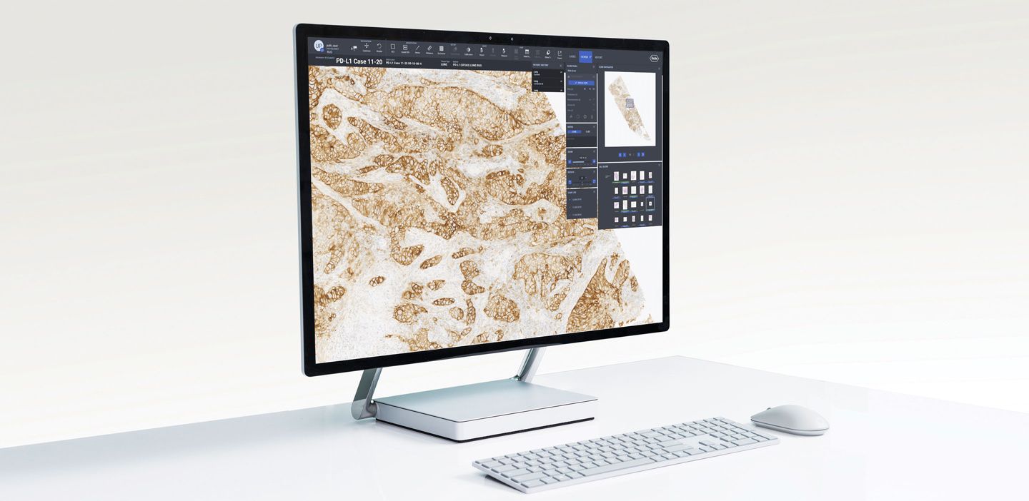Roche uPath enterprise software enhances the efficiency of digital pathology workflow in the laboratory