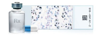 ventana her2 dual ish dna probe