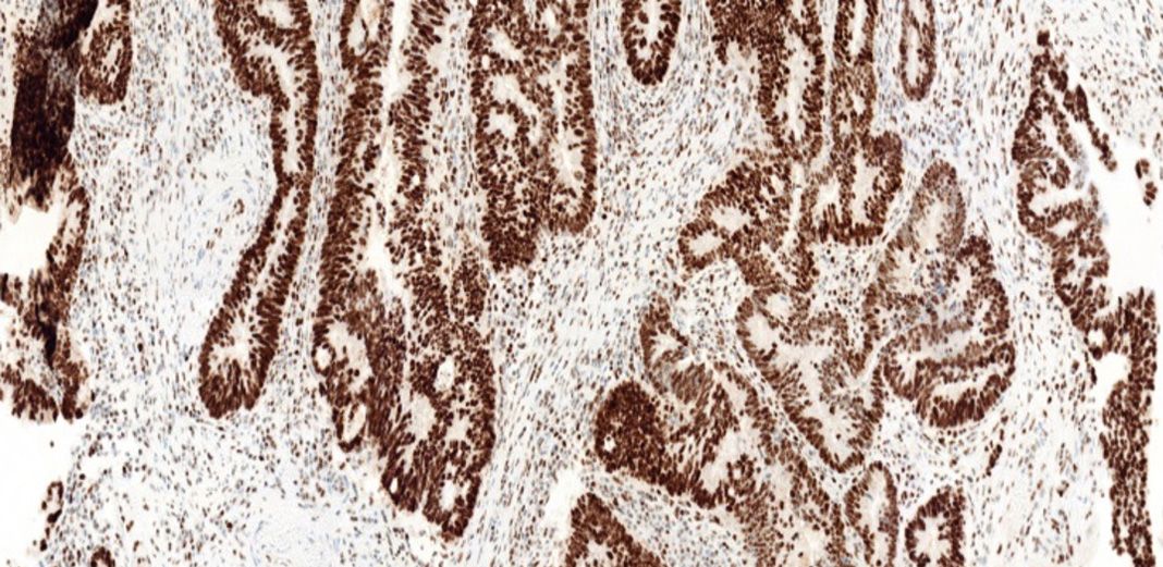 PMS2 (EPR3947) Rabbit Monoclonal Antibody