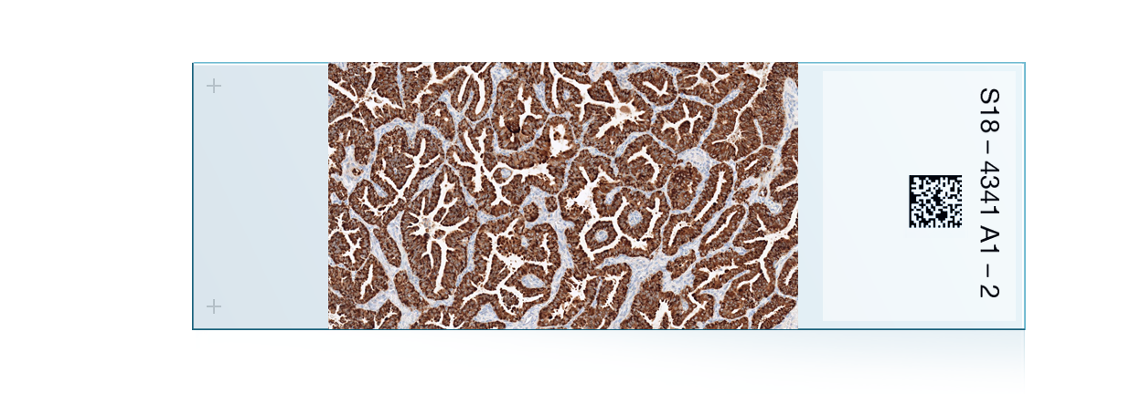 Lung Cancer Ihc Portfolio Lung Cancer Ihc Portfolio