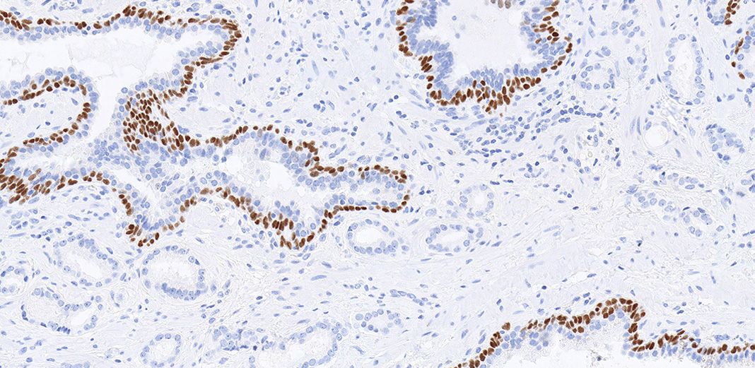 Clinical reagents and assays include the p63 (4A4) Mouse Monoclonal Primary Antibody