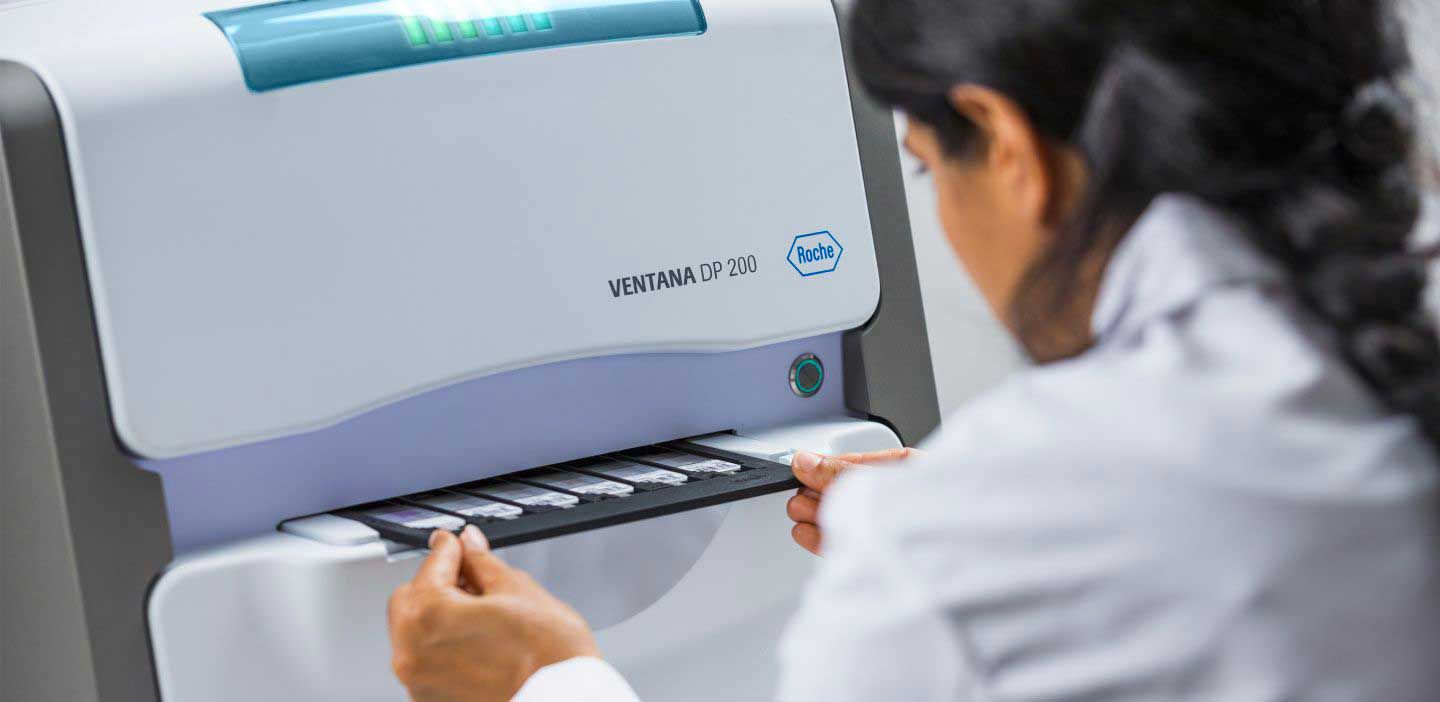 The VENTANA DP 200 digital pathology slide scanner tray