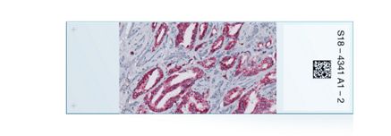 ulcerative colitis prostate