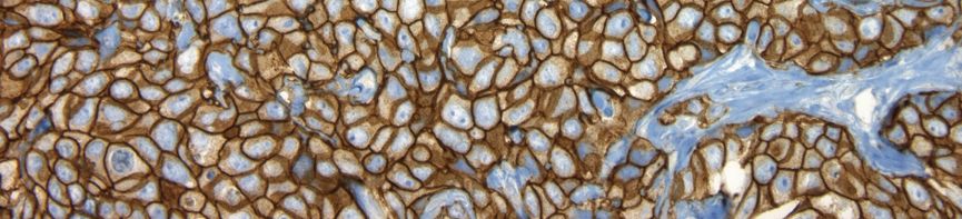 pathway-anti-her2-neu-4b5-rabbit-monoclonal-primary-antibody-fda