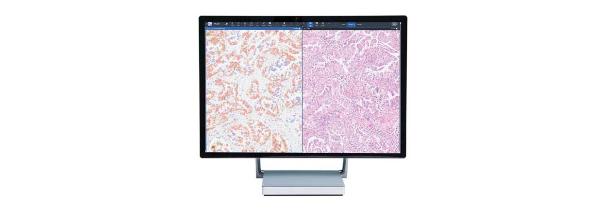 uPath PD-L1 (SP263) image analysis, NSCLC