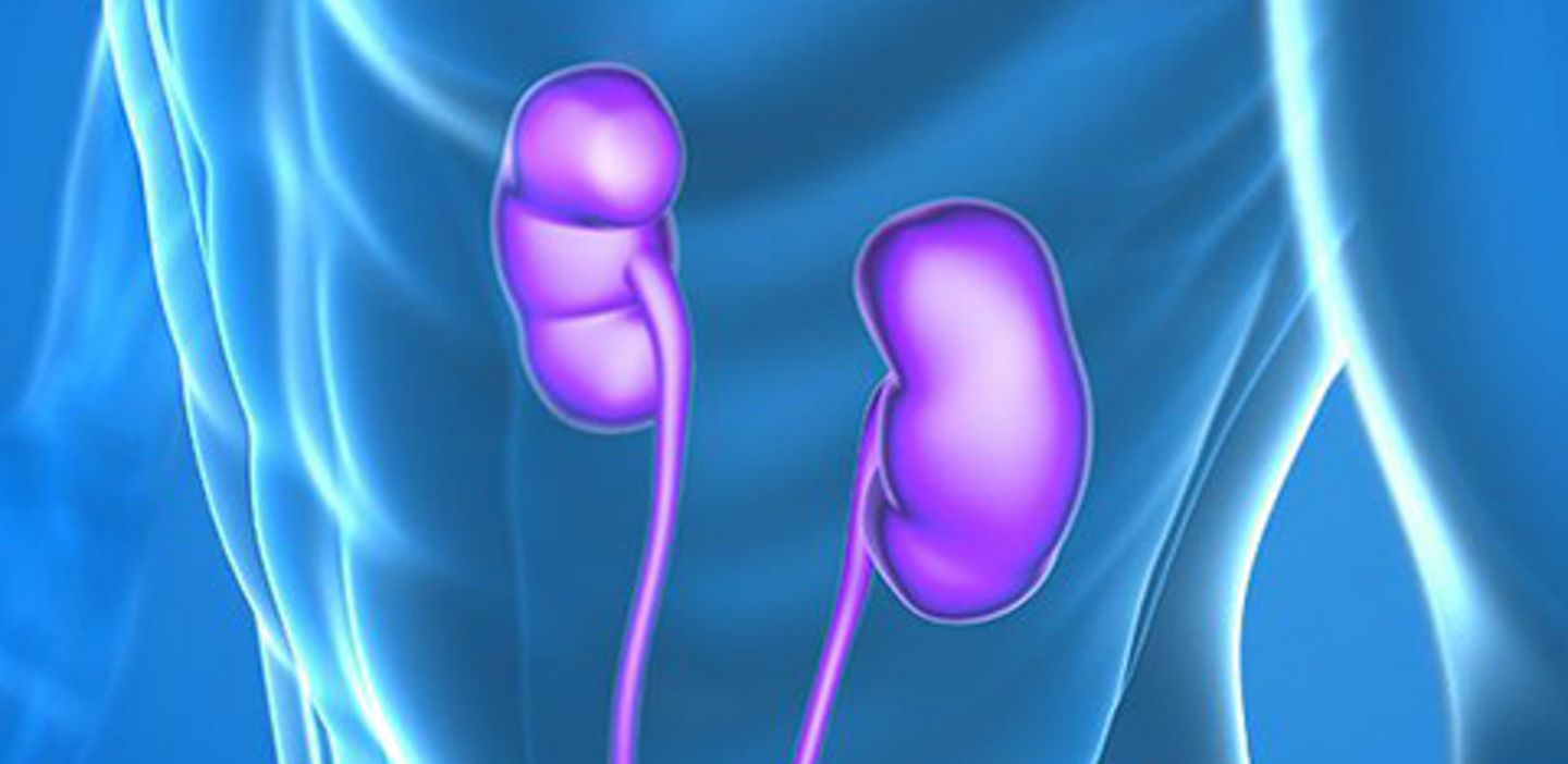 Kidney Transplant Transmitted Infections