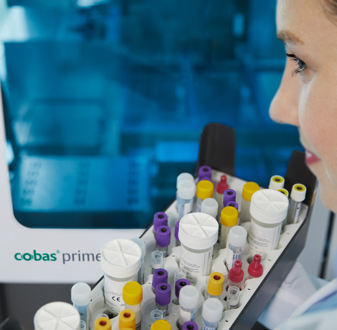 cobas® prime Preanalytical System