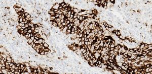 roche ventana antibody catalog roche ventana antibody catalog