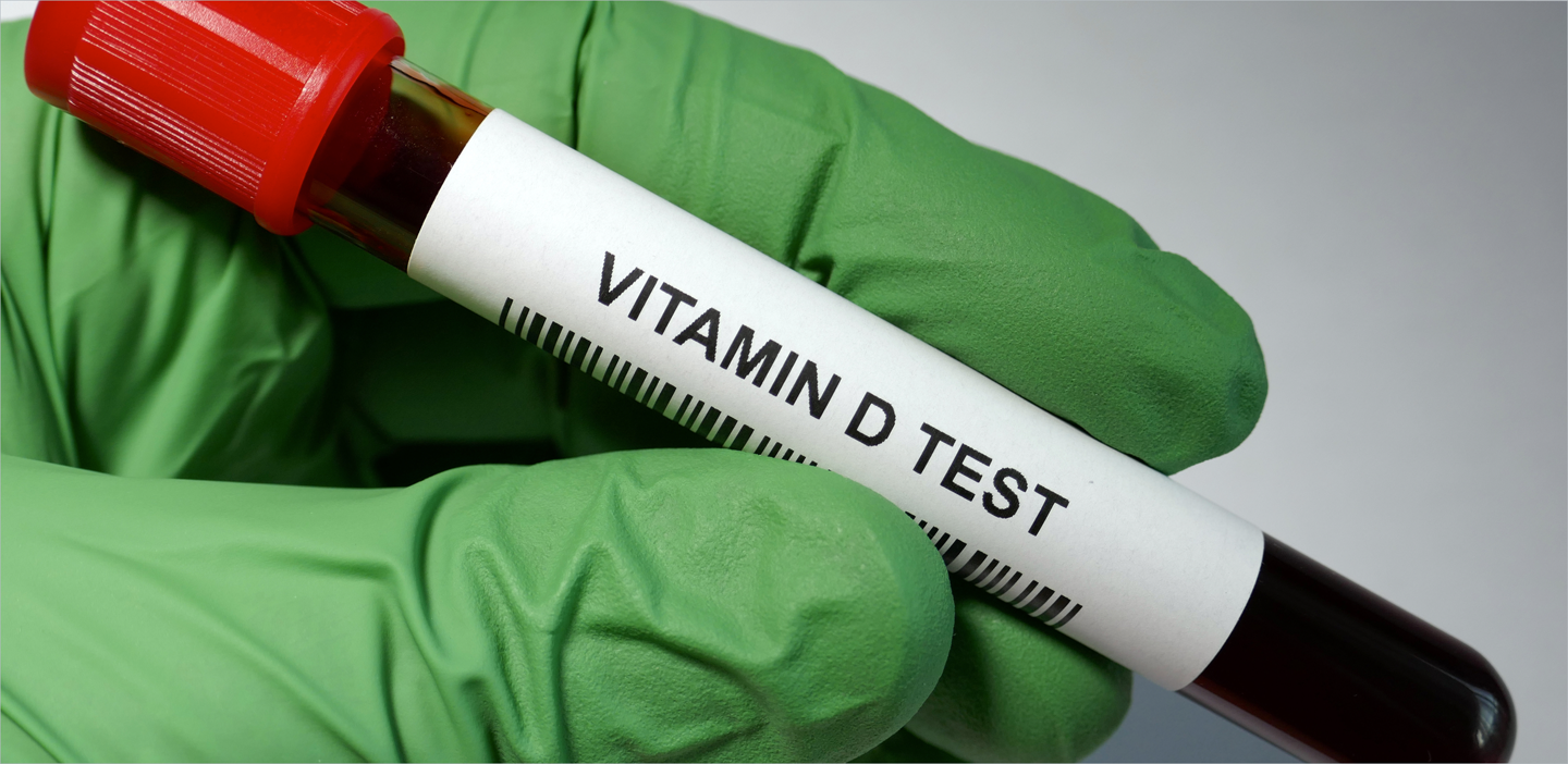 Raising the Standard: Unleashing the Power of Vitamin D Testing through Standardization