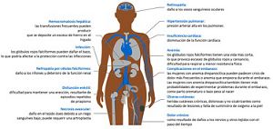 Tipos De Hemoglobina Anemia Falciforme